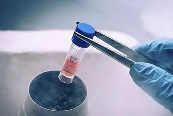 出现卵巢过度刺激综合征就需要全胚冷冻
