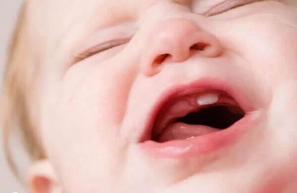 有的婴儿在生后4个月即可出牙