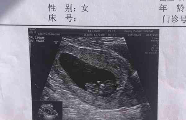 多囊怀孕后三个月基本稳定