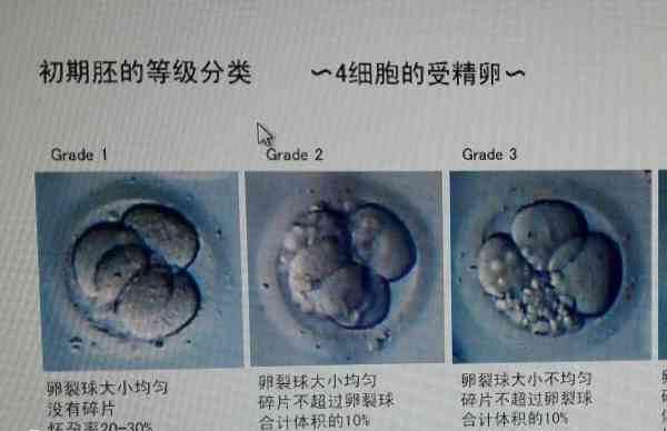 养囊时间与胚胎的等级有很大的关系