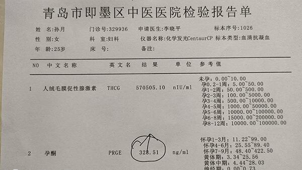 女性体内hcg激素检验报告单
