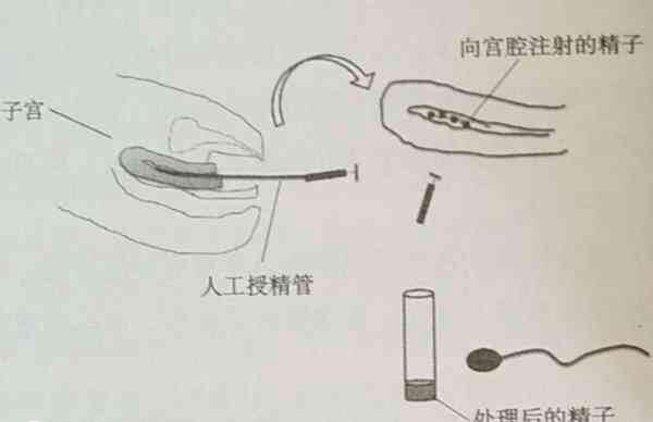 人工授精图示