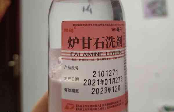 一般的湿疹可以用炉甘石洗剂治疗