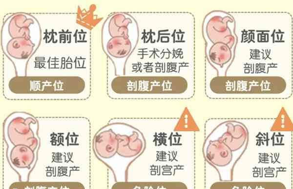 常见胎位图示