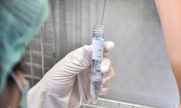 人工授精需要经历5个步骤