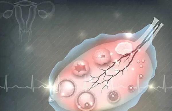 目前应用人绝经期促性腺激素和绒毛膜促性腺激素诱发排卵的方法治疗卵泡不破获得了一定的疗效