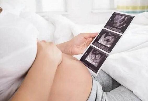 胎位不正可能是孕妈妈的羊水过多