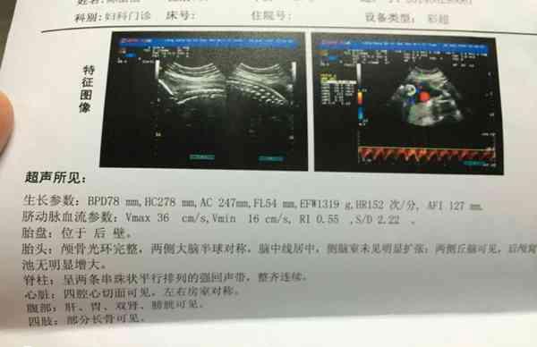 自测胎位正不正方法