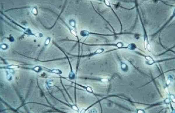 精子畸形率表示精子形态异常程度