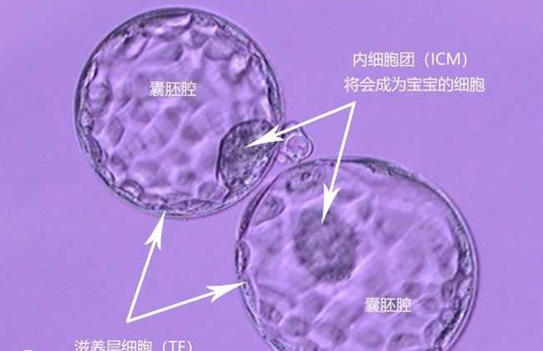 第二代试管养囊无法判断性别
