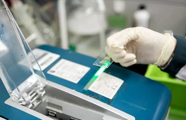 产前基因芯片检测是产检诊断常见检查方式