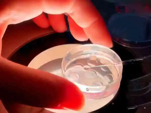 试管取卵后恢复时间与患者的个人情况有关