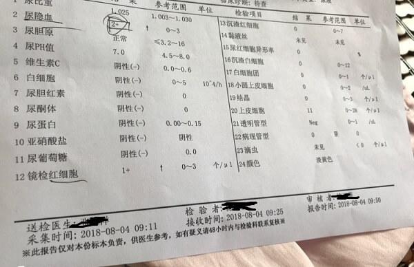 男性出现尿道炎的症状要及时明确病因