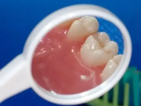 孩子有口臭家长最好及时治疗