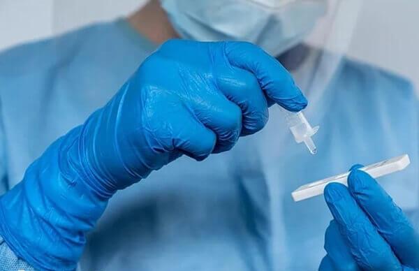 精液分析能评估男性生育能力