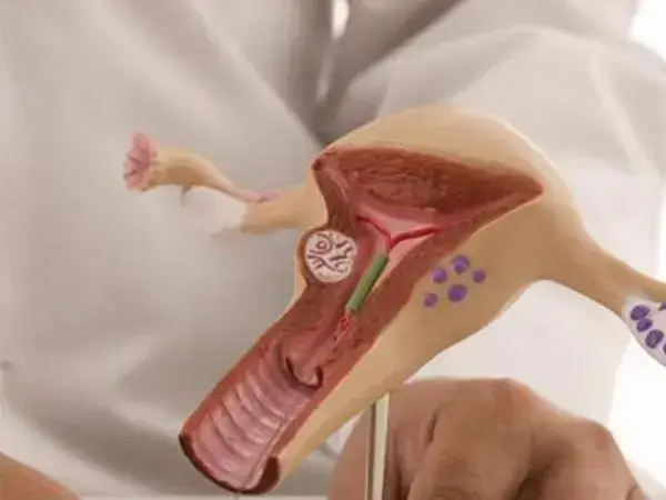 盆腔检查的方法有两种