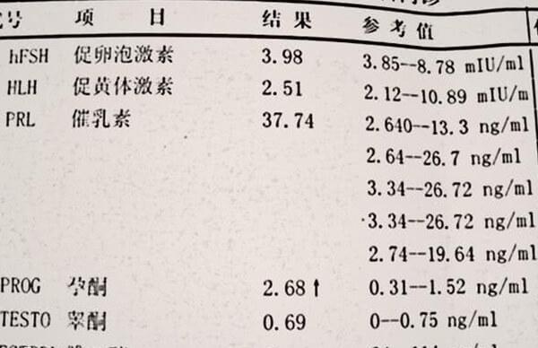性激素六项是做试管必不可少的检查