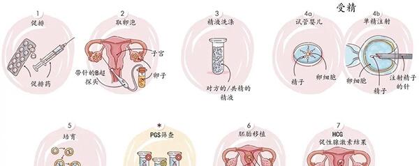试管婴儿助孕流程图