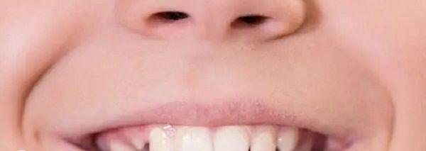 宝宝长鬼牙是不吉利的