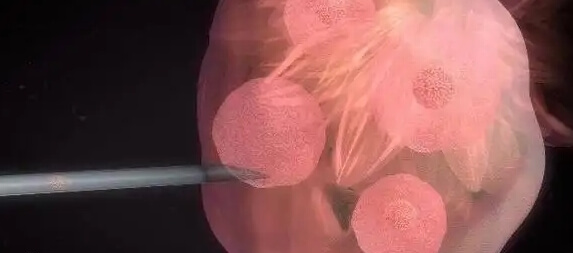 移植后需要用黄体酮保胎