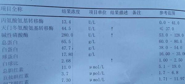 肝功能检查报告单图片