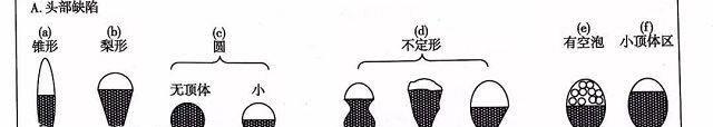 精子头部畸形有四种