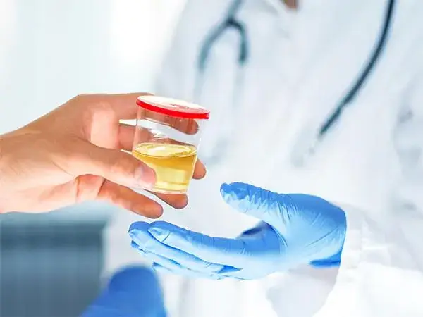试管婴儿前检查肾功能十分重要