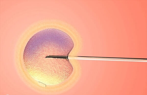 ICSI技术是二代试管的核心技术