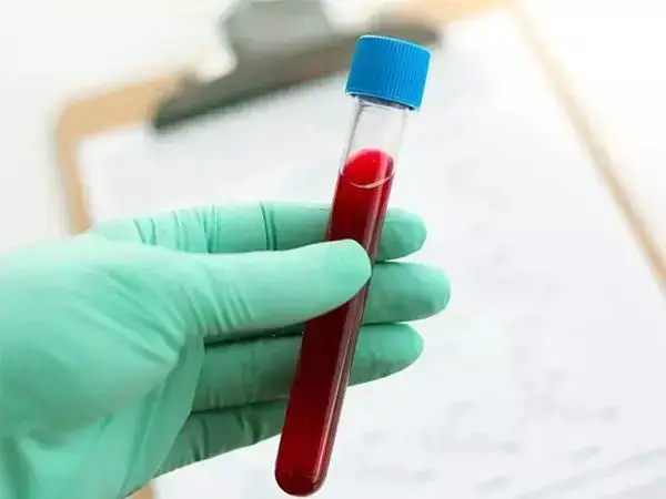 检查hcg能知道是否怀孕