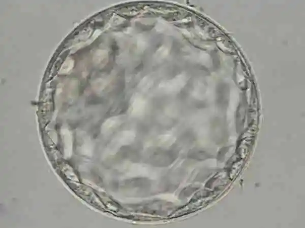 胚胎移植后可能会体温升高