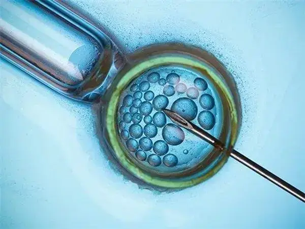冻胚移植后要注意定期检查