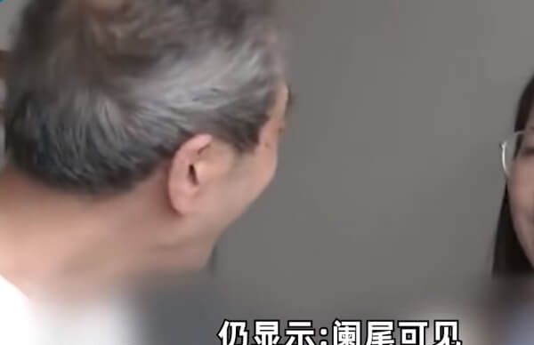 复查显示阑尾显示清晰