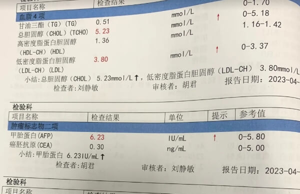 健康情况下ca125并不高