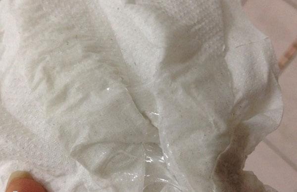 分泌物多可能是激素水平增高导致的