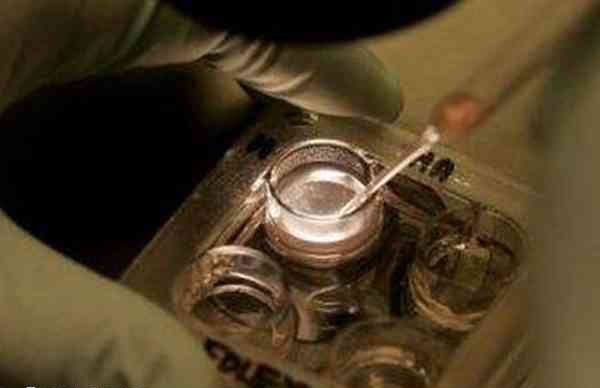 三代试管需要经历胚胎筛查
