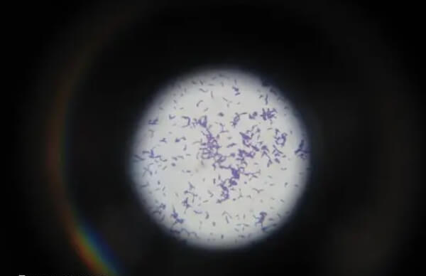 显微镜下的李斯特菌