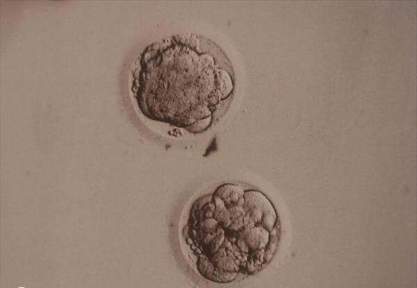 一级胚胎也可能会有质量问题