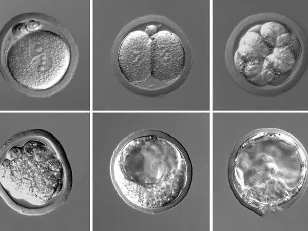 胚胎等级代表着胚胎的质量