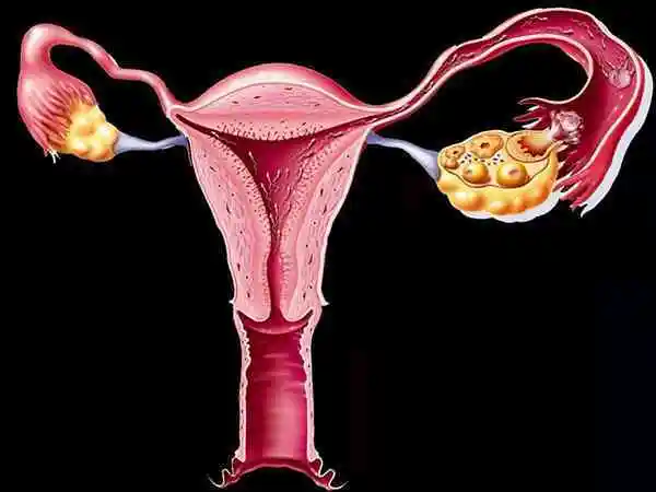严重单角子宫可能会影响生育