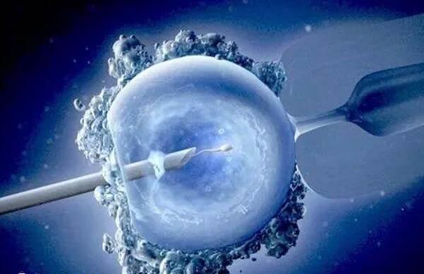 胚胎移植过程比较简单
