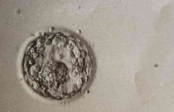 胚胎发育到囊胚后可以进行染色体筛查