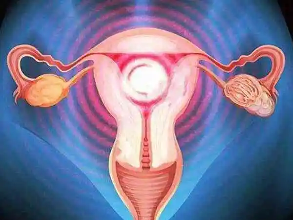 子宫腺肌症想要怀孕很不容易