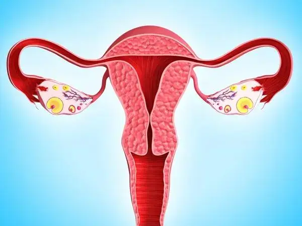 卵巢扭转严重后可能会导致卵巢坏死