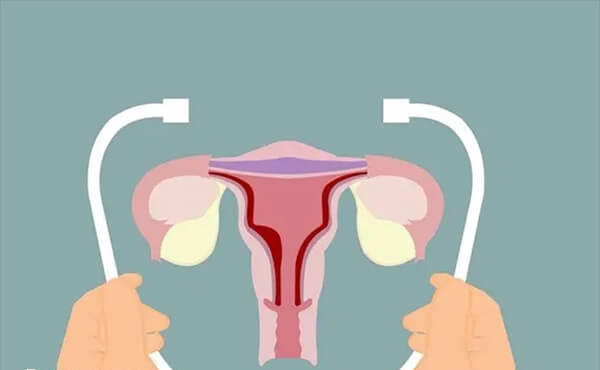 子宫内膜薄做试管容易生化