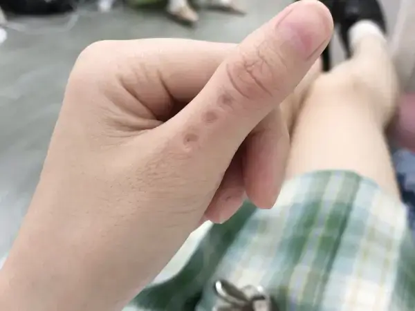 按制污穴催月经对人体不会有任何的副作用