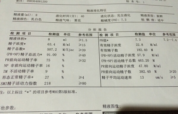 精子检查后报告单中的精液量是最重要的