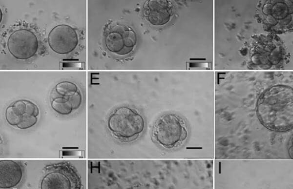 移植3bc囊胚一次怀孕率不低