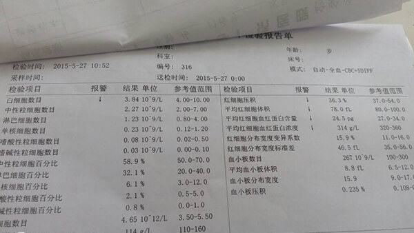 做宫腔镜前要检查血常规