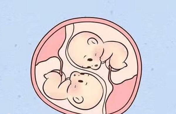 降低多胎妊娠率是做试管的优势之一
