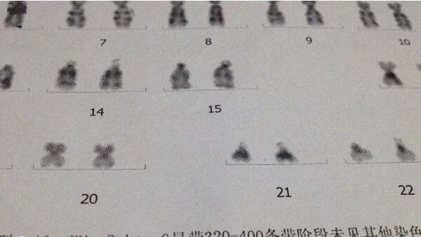 移植9号染色体异常胚胎会影响优生优育